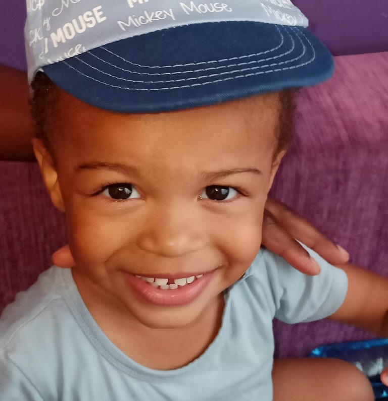 Potrzebna nowa proteza dla 3-letniego Alexa!